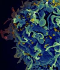 Які клітини вражає вірус СНІДу?